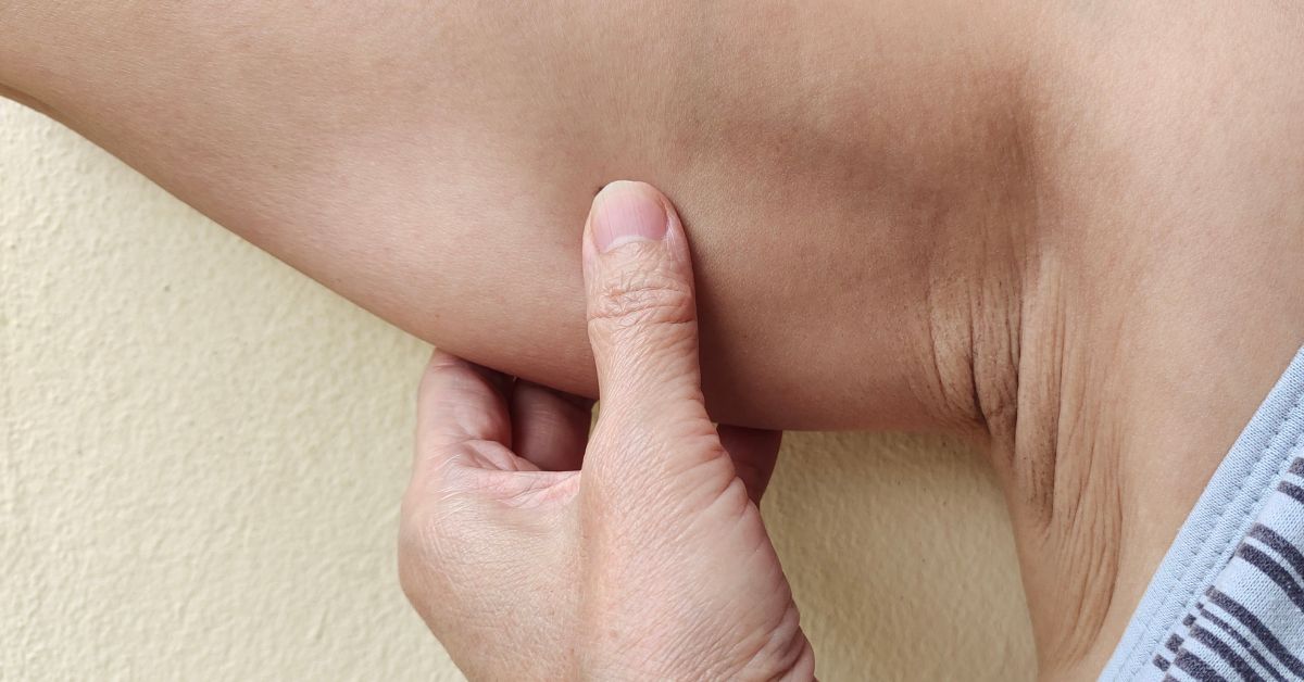 Bras flasques : que faire après 50 ans pour les raffermir sans effort ?